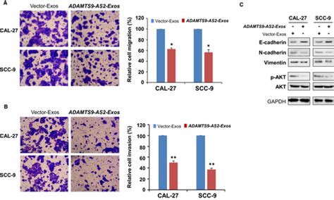 Exosome‐derived Long Non‐coding Rna Adamts9‐as2 Suppresses Progression