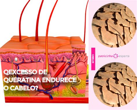 Queratina O Que Quando Usar Como Usar Como Patricinhaesperta