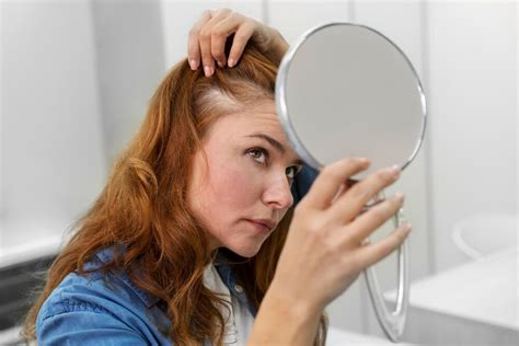 Facts You Should Know About Stress And Hair Loss Mentoworld