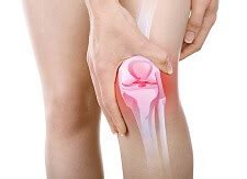 Gout Knee: Causes, Symptoms & Treatment - Knee Pain Explained