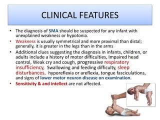 spinal muscular atrophy sma pptx