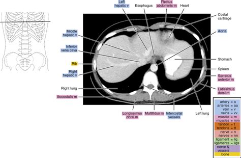 CT of the abdomen | Radiology Key