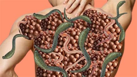 Asmr Animation Trypophobia Insect Treatment From Infected Back Asmr