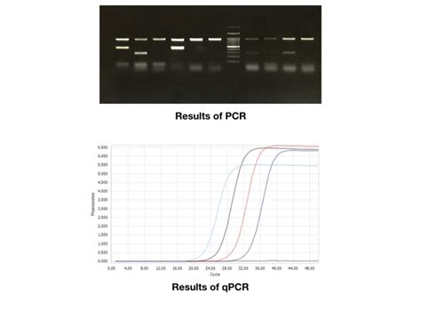 Differences Between Pcr Vs Qpcr Genetic Education