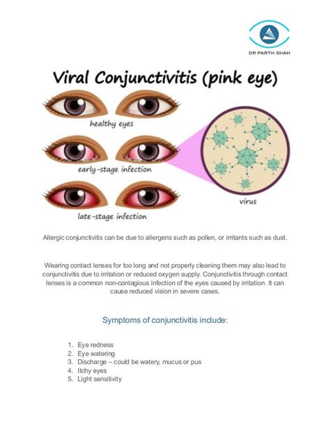 Red eyes – causes, symptoms, treatment and prevention