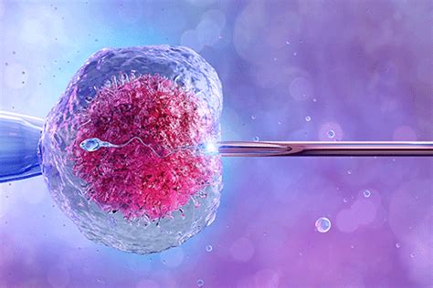 Inyección Intracitoplasmática de Espermatozoides ICSI