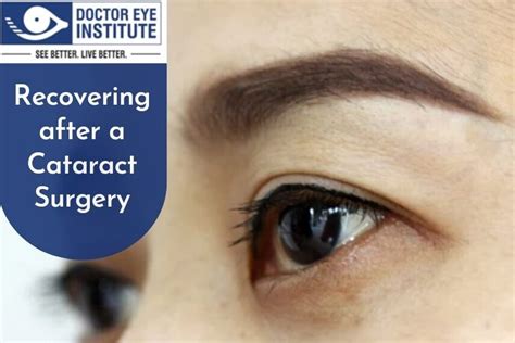 Recovering After A Cataract Surgery Doctor Eye Institute