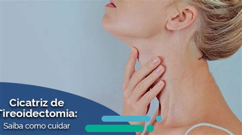 Como cuidar da sua cicatriz após a cirurgia da tireoidectomia Dr