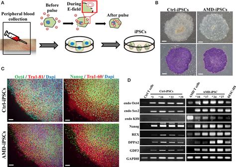 Generation And Characterization Of Ipscs Derived From Patients With