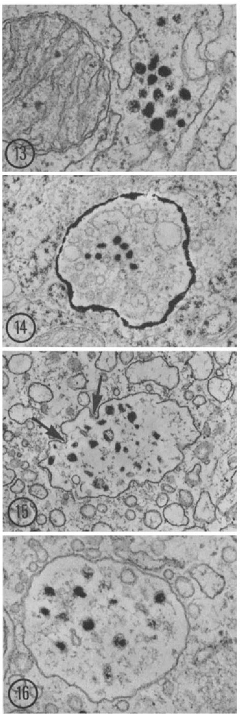 Figure 1 From Cytochemical Staining Of Multivesicular Body And Golgi