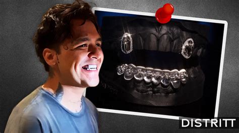 Christian Nodal Cuánto cuesta su dentadura de diamantes