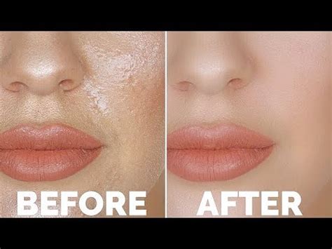 How To STOP Oily Skin The Number 1 Oily Skin Trick You NEED TO KNOW