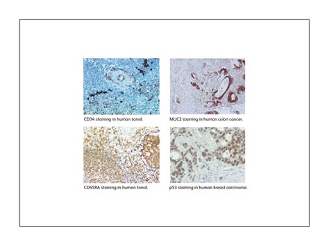 Immunohistochemistry Antibody Staining Ihc Detection