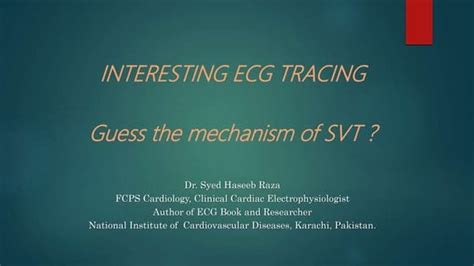 ecg situs inversus atrialis