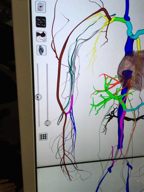 arm veins Diagram | Quizlet