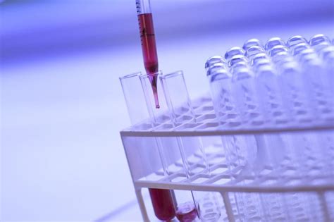 Biomarker Analysis and Assay - Alera Labs, LLC