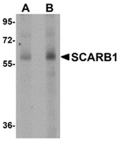 Sr Bi Polyclonal Antibody Pa5 20756