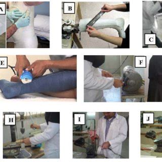 Ten Working Postures of Orthotists A, Casting. B, Positive cast... | Download Scientific Diagram