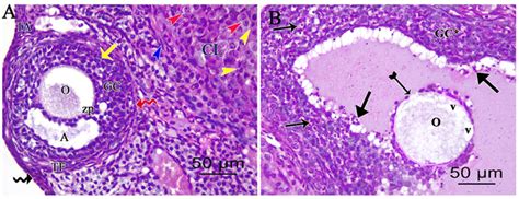 Photomicrographs Of H E Stained Ovarian Sections Of Cisplatin