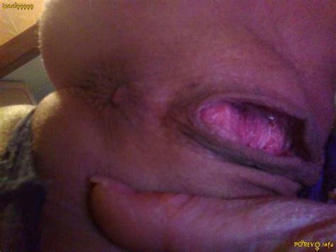 Private Pics Broken Holes 634034 2898830 крупный план киска Porn Pic
