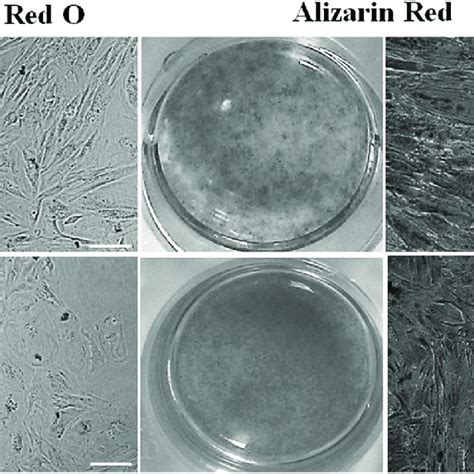 Differentiation Of Eutopic And Ectopic Mscs Eutopic And Ectopic Download High Quality