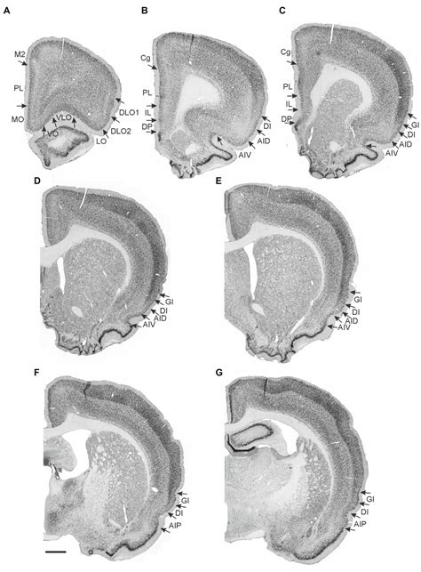 Frontiers Projections Of The Insular Cortex To Orbitofrontal And