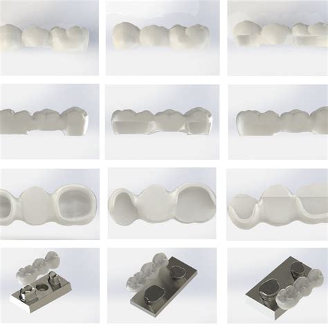 Models of adhesive bridge and abutment: left -(T), in the centre -(VO ...