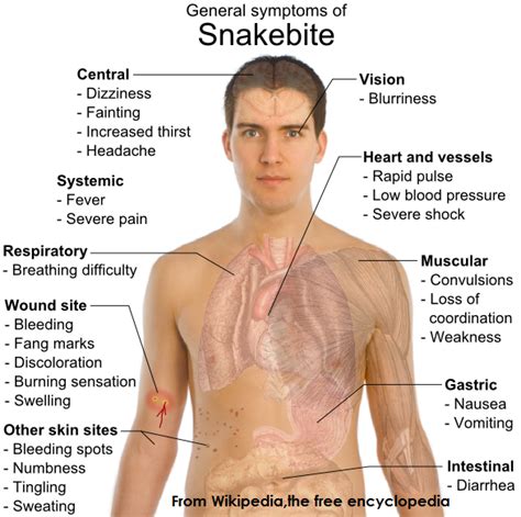 Snake Bites and their emergency treatment - Medicalopedia