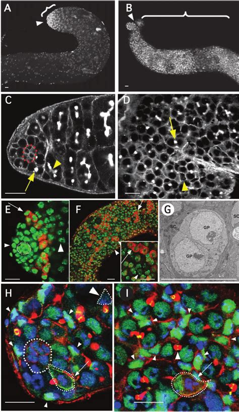 Ectopic Jak Stat Signaling Expands The Germ Line And Somatic Stem Cell