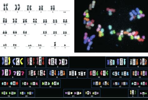 Karyotypic Analysis Representative SKY And G Banding Karyotype Image