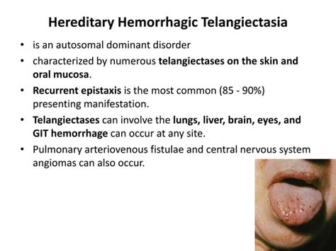 Dermatology 5th Year 3rd Lecture Dr Faraedon Kaftan