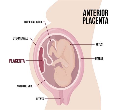 Qu est ce qu un placenta antérieur My Blog