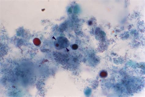 Public Domain Picture This Trichrome Stained Photomicrograph Depicts A Single Iodamoeba