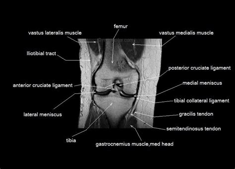 Knee Anatomy Mri