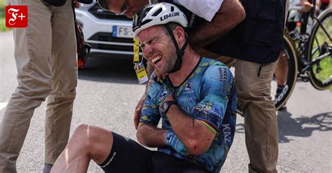 Nach Sturz Schmerzhaftes Aus bei Tour de France für Mark Cavendish