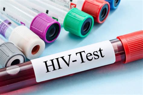 Free HIV Testing Locations – QNotes