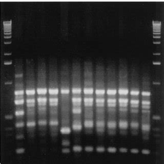 Pfge Patterns Of Sfi I Digested Dna Of C Diphtheriae Strains Lanes