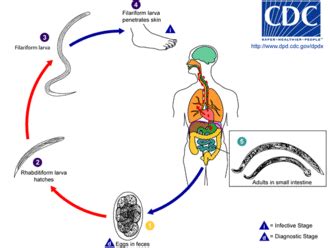 Hookworm infection - Wikipedia