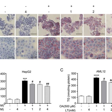 L Theanine Alleviates Hepatic Steatosis In Oa Induced Hepg2 And Aml12