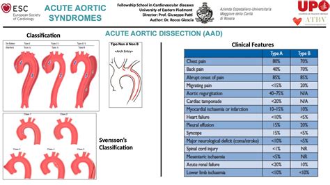 Sindromi Aortiche Acute Atbv