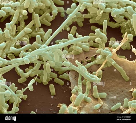 Bacterias Streptomyces Color An Lisis Micrograf A De Electrones Sem