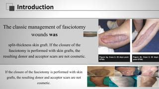 dermatotraction  surgical wound closures methods dr ali baratpptx