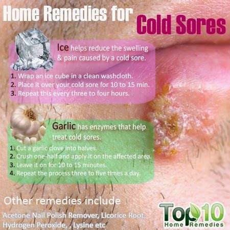 Home Remedies for Cold Sores ~ Mzizi Mkavu