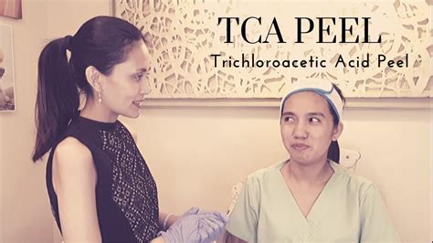 Tca Peel For Acne Scars Trichloroacetic Acid Peel Youtube