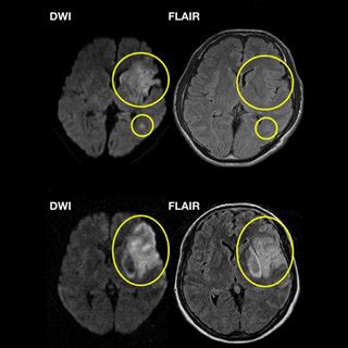 Synthetic Multi-Exposure Speckle Imaging. (a) Schematic of the imaging ... 