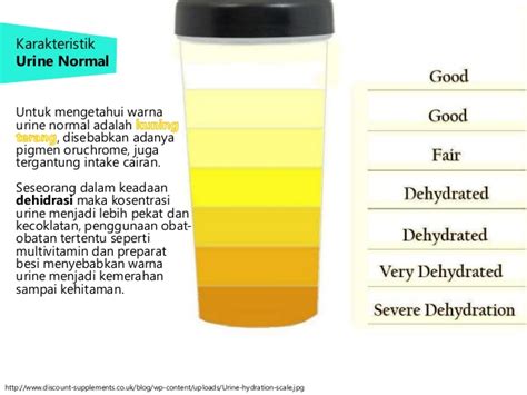 Ini Alasannya Kenapa Air Kencing Berwarna Kuning Setujukan