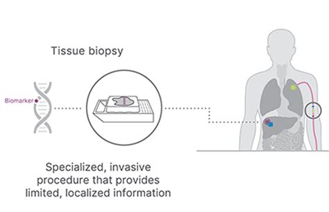 Cancer Liquid Biopsy Research Detecting Tumor Derived Biomarkers