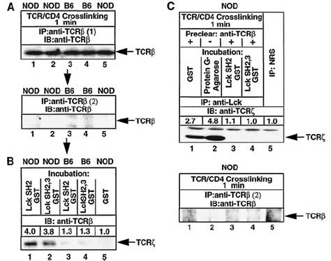 Interaction Between Lck And Free Tcr Chains Is Mediated By The Lck