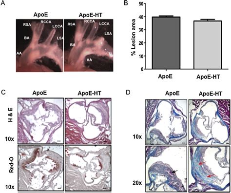 Characterization Of Atherosclerotic Plaque Formation In Apoe Vs Apoe Ht