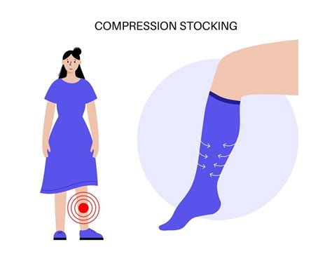 Medicare Coverage for Compression Socks | Medigap.com 